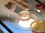 马来西亚试管婴儿三次成功的真实费用与案例分析